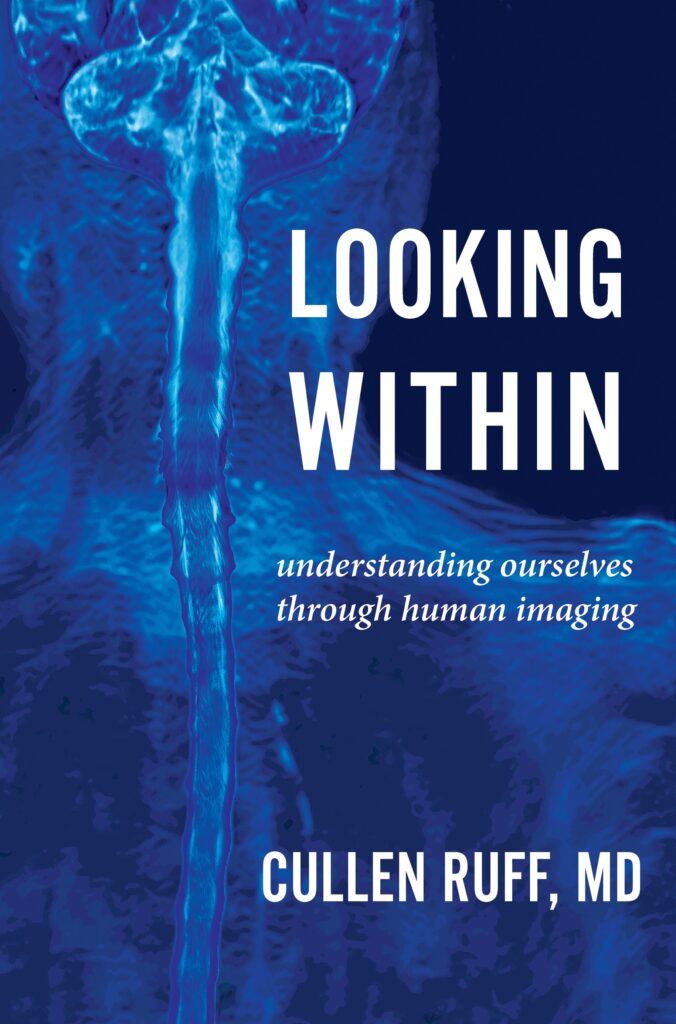 Cover of Looking Within by Cullen Ruff, MD